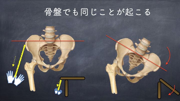 骨盤の水平を傾き